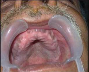 http://www.jdrntruhs.org/articles/2013/2/4/images/JNTRUnivHealthSci_2013_2_4_292_122177_f1.jpg