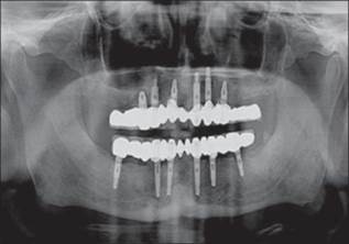http://www.jdrntruhs.org/articles/2013/2/4/images/JNTRUnivHealthSci_2013_2_4_292_122177_f10.jpg