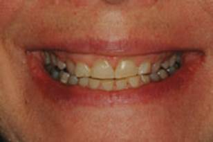 https://www.dentistrytoday.com/Media/EditLiveJava/1111_Engelberg_02.jpg