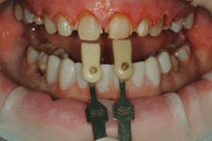 https://www.dentistrytoday.com/Media/EditLiveJava/1111_Engelberg_06.jpg