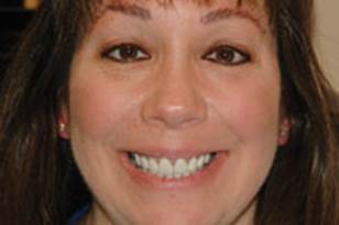 https://www.dentistrytoday.com/Media/EditLiveJava/1111_Engelberg_07.jpg