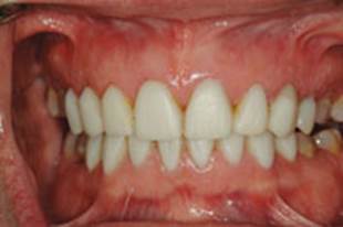 https://www.dentistrytoday.com/Media/EditLiveJava/1111_Engelberg_08.jpg