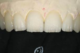 https://www.dentistrytoday.com/Media/EditLiveJava/1111_Engelberg_17.jpg