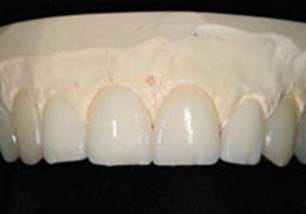 https://www.dentistrytoday.com/Media/EditLiveJava/1111_Engelberg_19.jpg