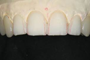https://www.dentistrytoday.com/Media/EditLiveJava/1111_Engelberg_20.jpg