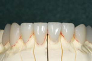 https://www.dentistrytoday.com/Media/EditLiveJava/1111_Engelberg_22.jpg