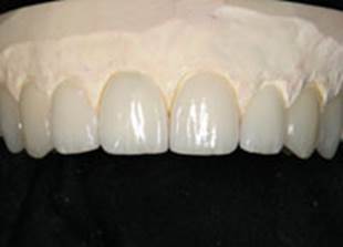 https://www.dentistrytoday.com/Media/EditLiveJava/1111_Engelberg_23.jpg