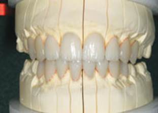https://www.dentistrytoday.com/Media/EditLiveJava/1111_Engelberg_24.jpg