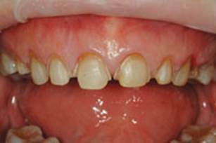 https://www.dentistrytoday.com/Media/EditLiveJava/1111_Engelberg_25.jpg