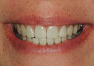 https://www.dentistrytoday.com/Media/EditLiveJava/1111_Engelberg_27.jpg